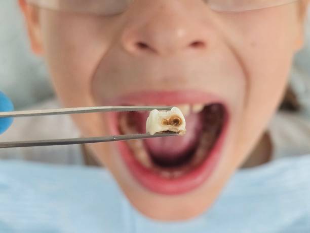 Best Urgent Tooth Repair  in Ansonia, CT