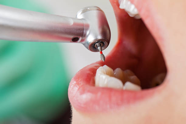 Best Knocked-Out Tooth Emergency  in Ansonia, CT